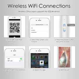 دوربین بازرسی قابل حمل خانگی Joto Otoscope Wireless JPG برای Iphone و Android